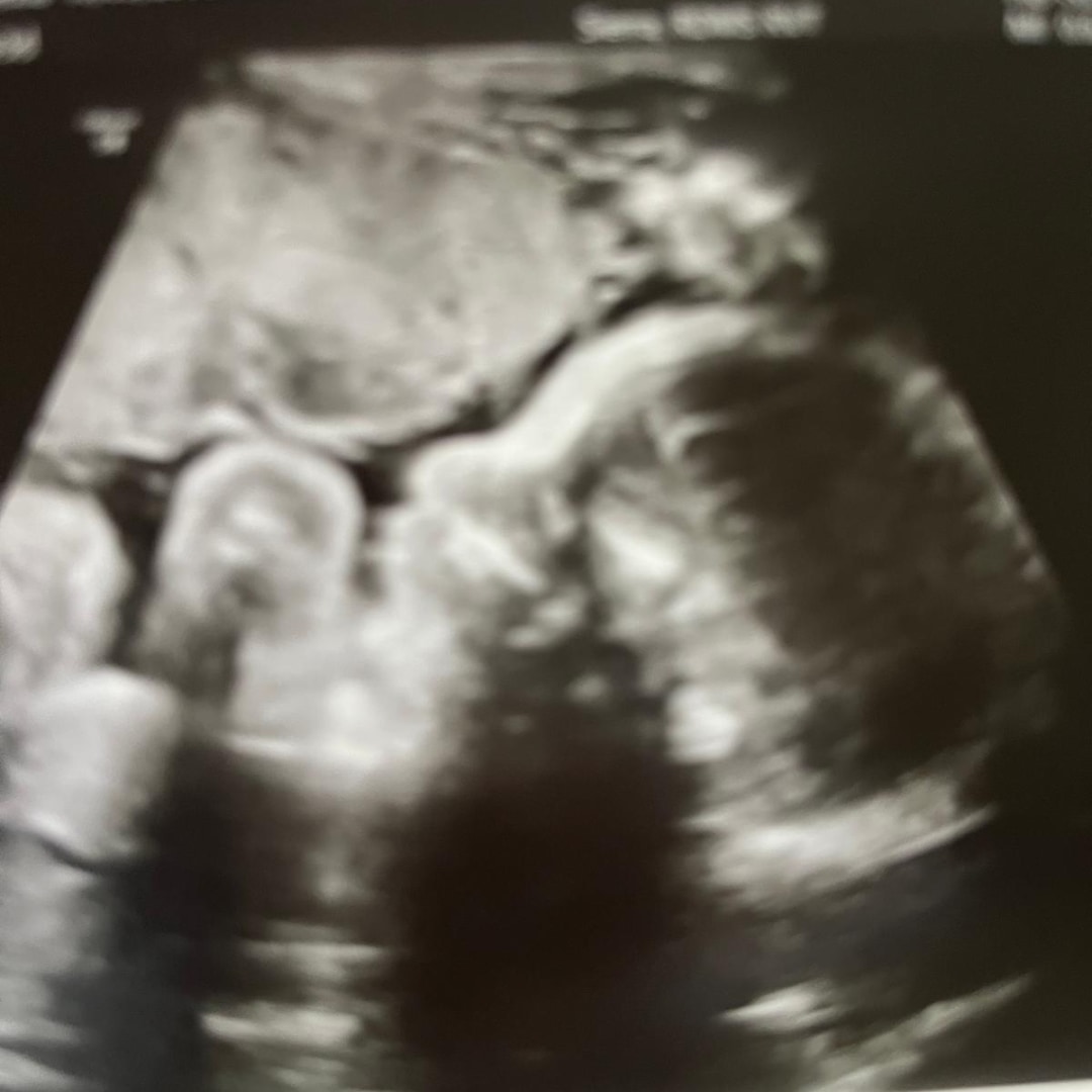 Photo shared by Alexia for their Babylist baby registry.