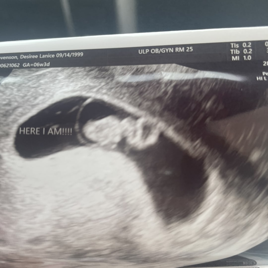 Photo shared by Desiree for their Babylist baby registry.