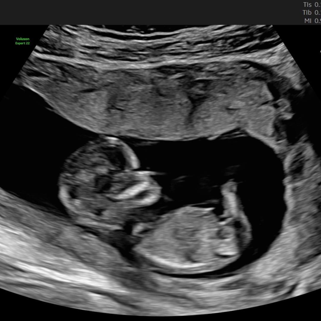 Photo shared by Mariah for their Babylist baby registry.