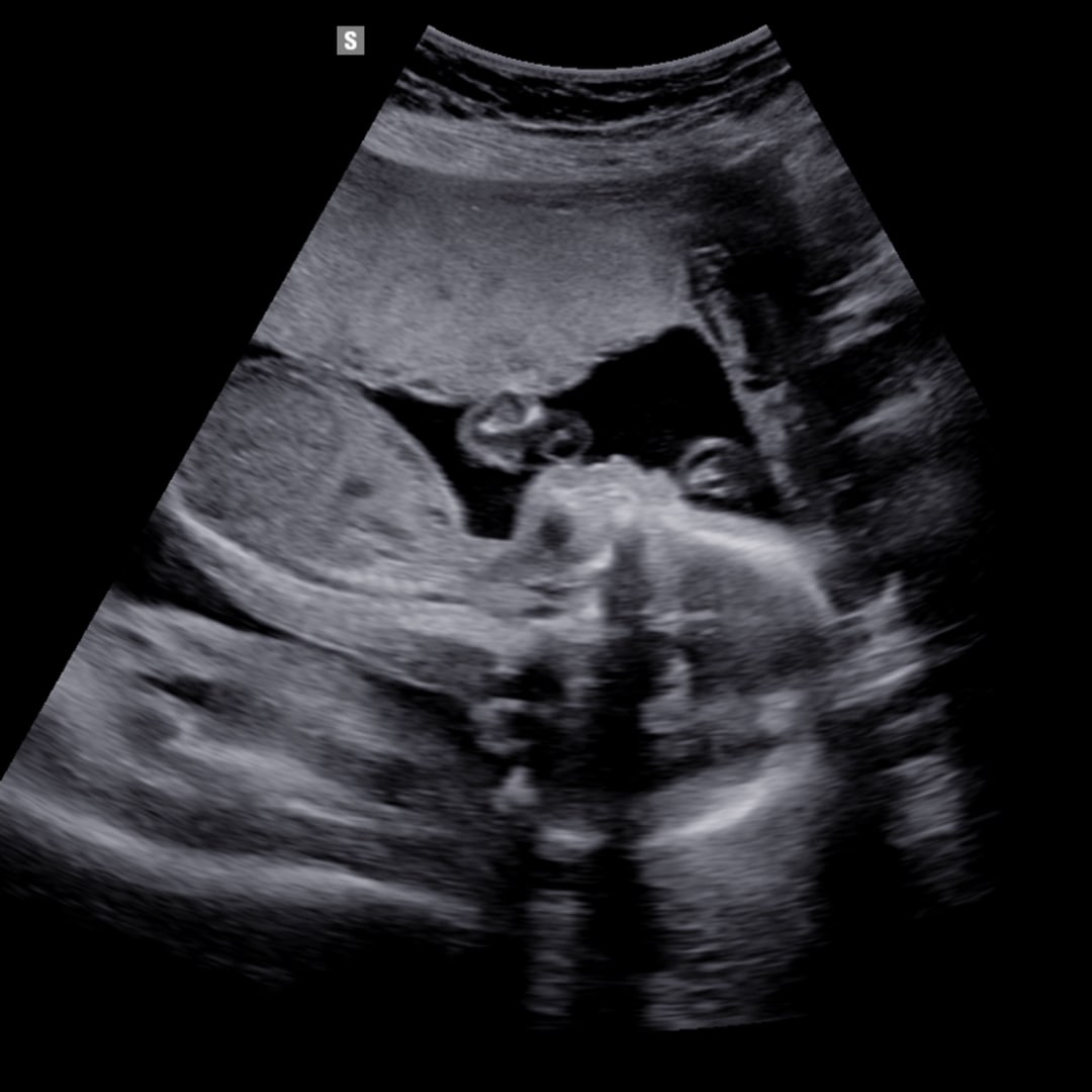 Photo shared by Cameron for their Babylist baby registry.