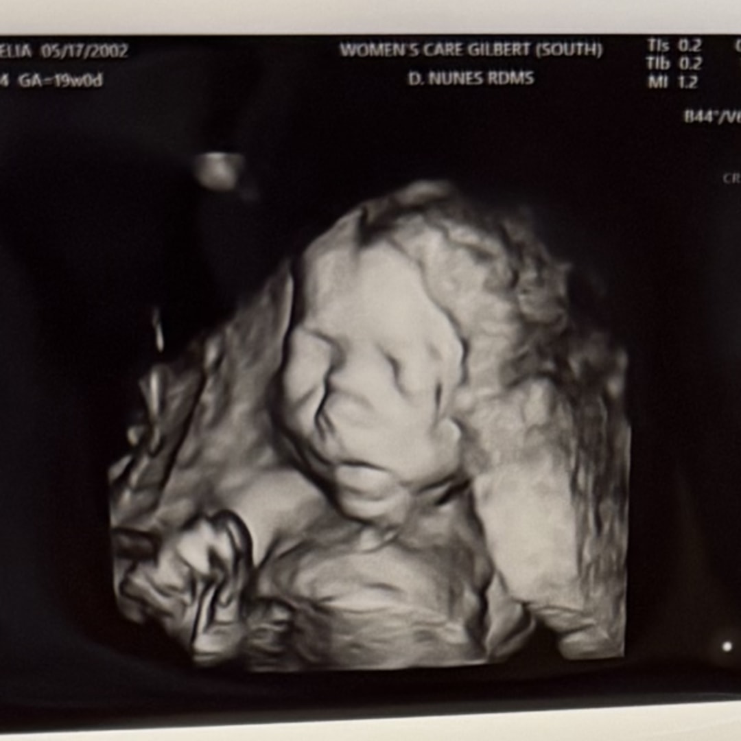Photo shared by Elia for their Babylist baby registry.