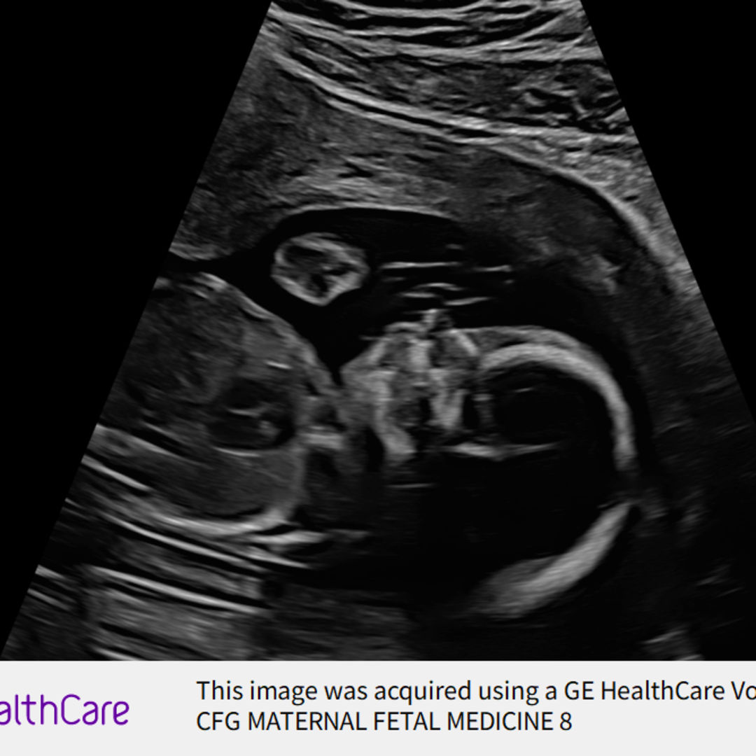 Photo shared by Ashley for their Babylist baby registry.