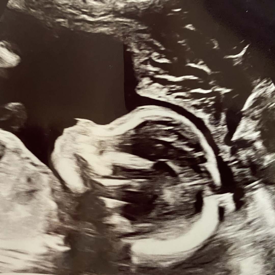 Photo shared by Tina for their Babylist baby registry.