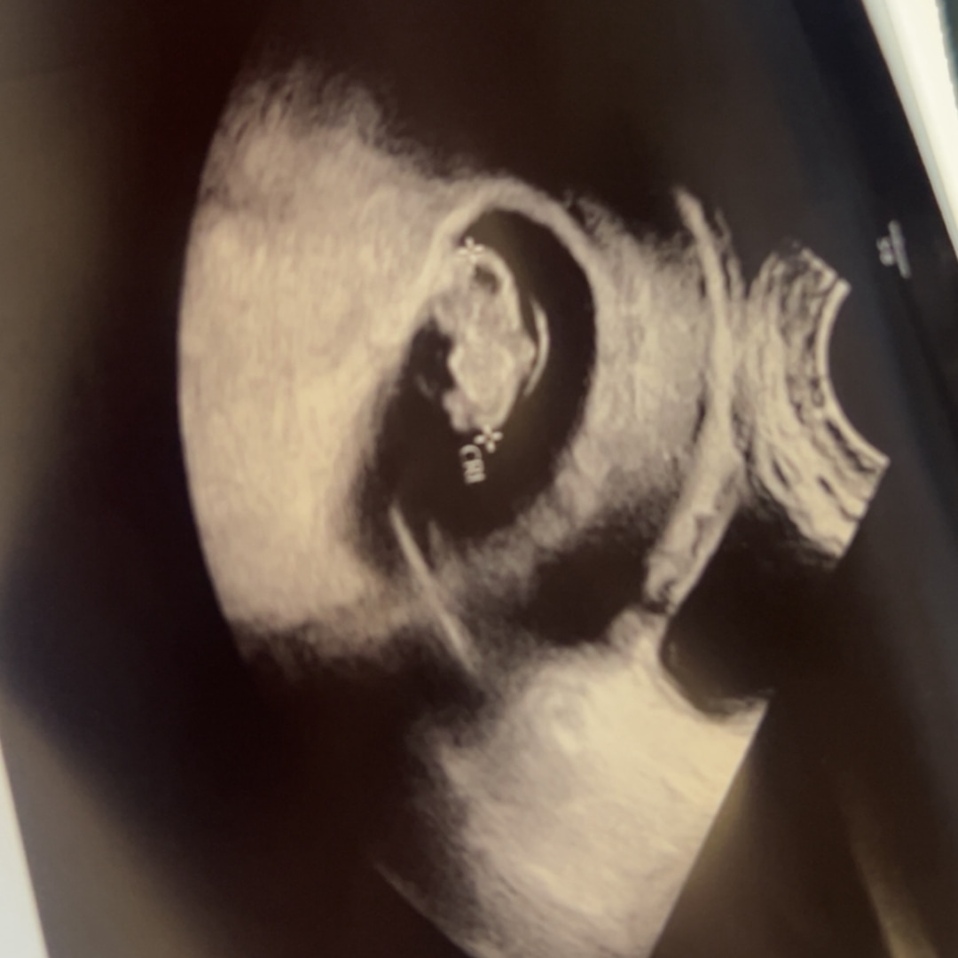 Photo shared by Alexis for their Babylist baby registry.