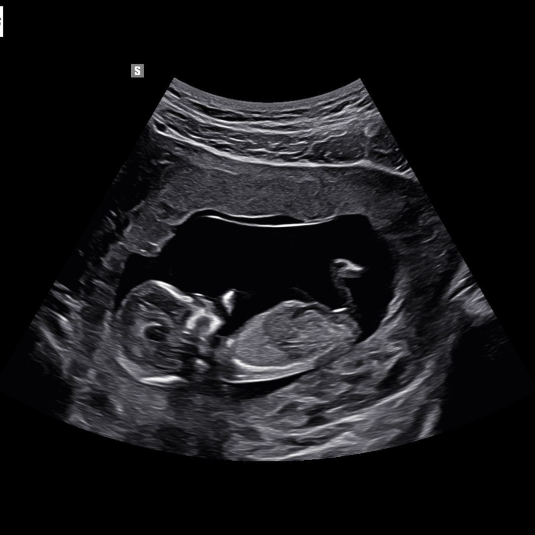 Photo shared by Caroline for their Babylist baby registry.