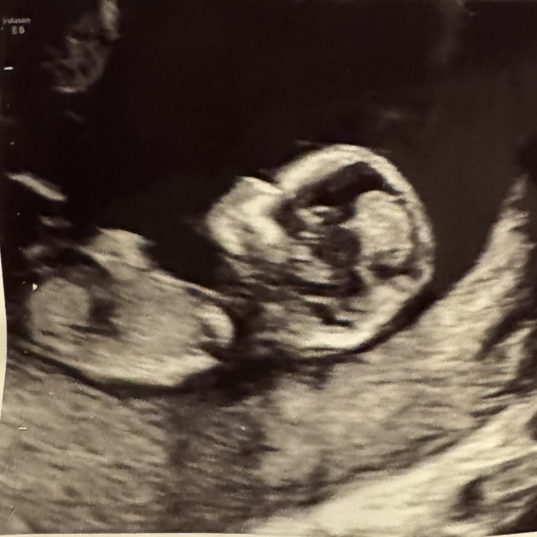 Photo shared by Hayley for their Babylist baby registry.