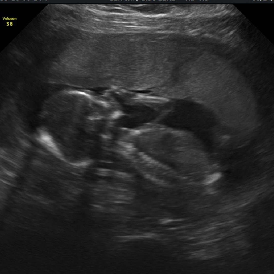Photo shared by Savannah for their Babylist baby registry.