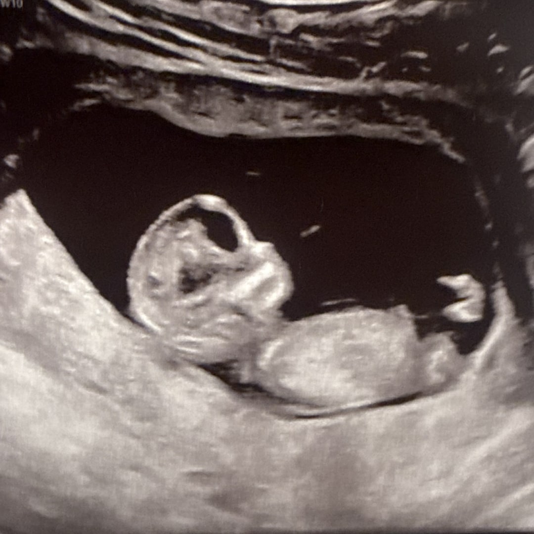 Photo shared by Anna for their Babylist baby registry.