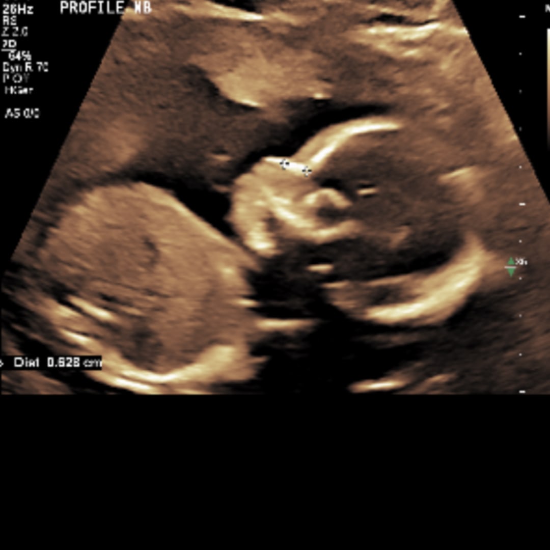 Photo shared by Metta for their Babylist baby registry.