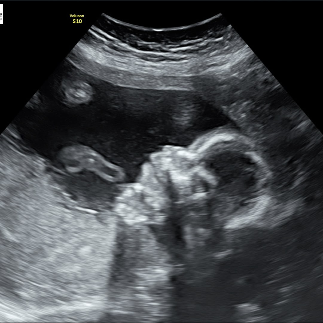 Photo shared by Brenda for their Babylist baby registry.