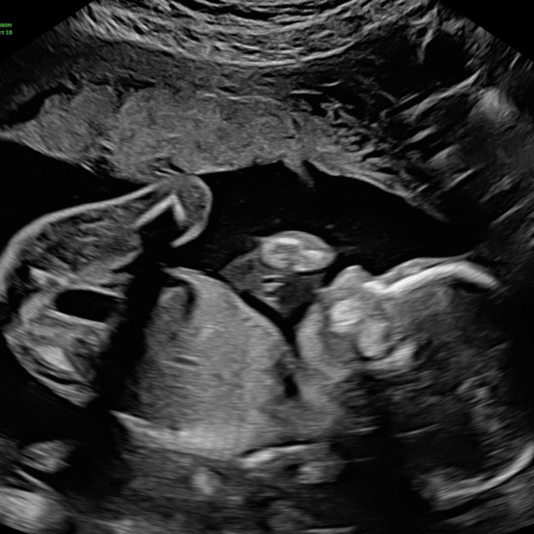 Photo shared by Zaina for their Babylist baby registry.