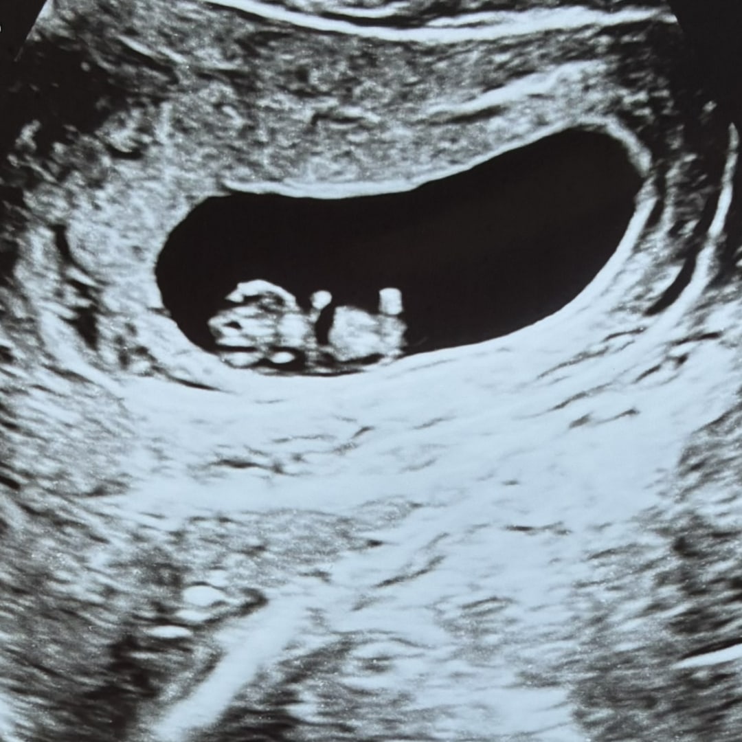 Photo shared by Daja for their Babylist baby registry.