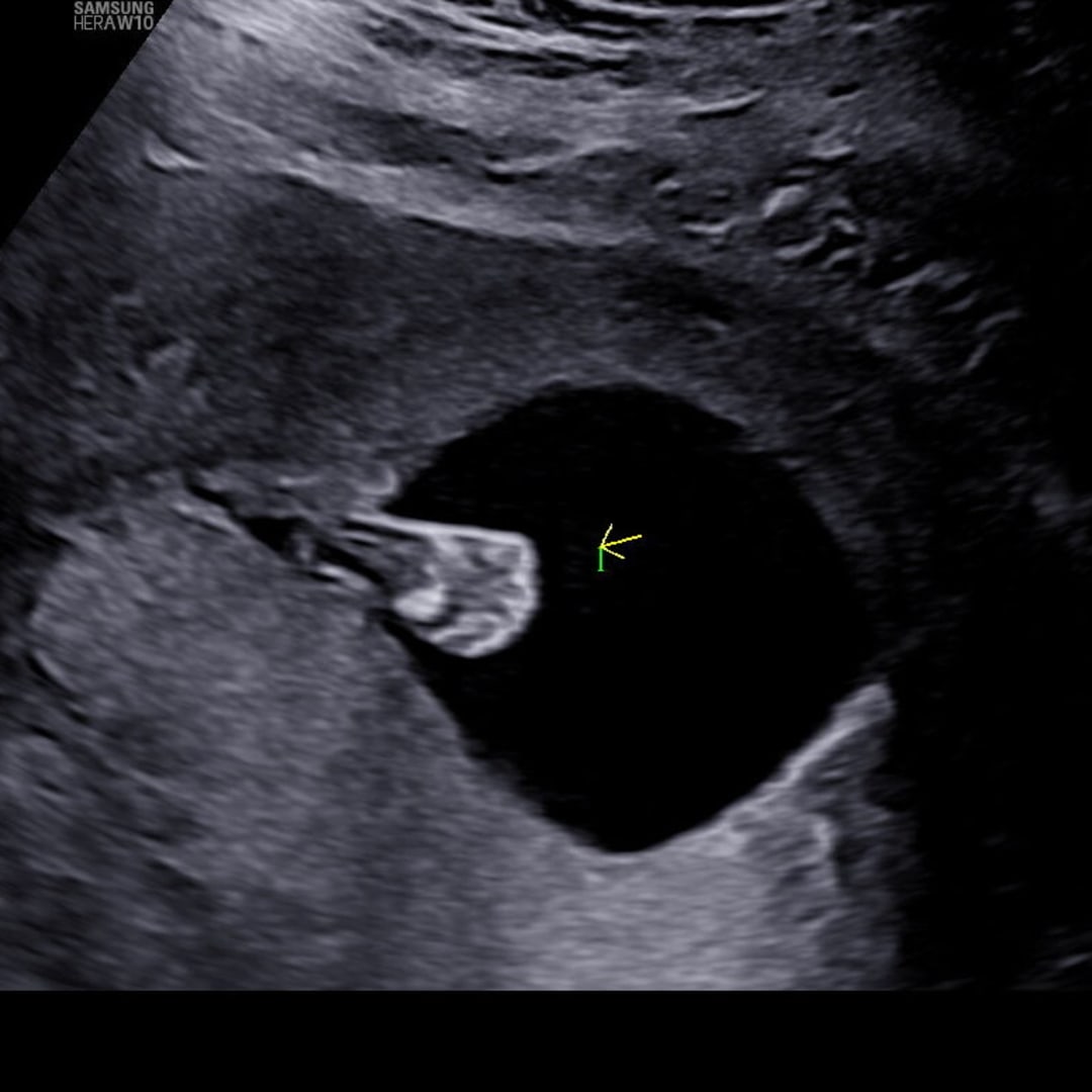 Photo shared by Charmaine for their Babylist baby registry.