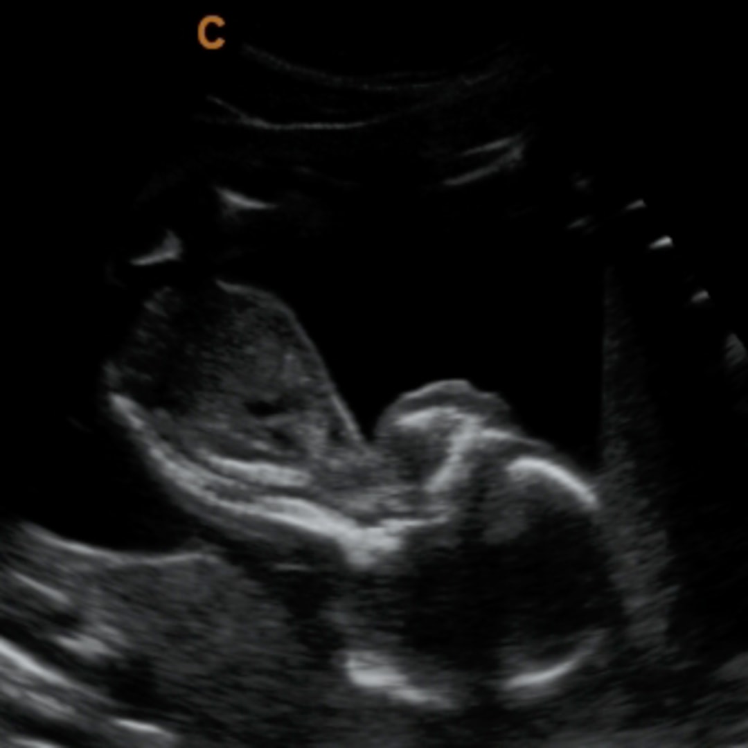 Photo shared by Emylia for their Babylist baby registry.