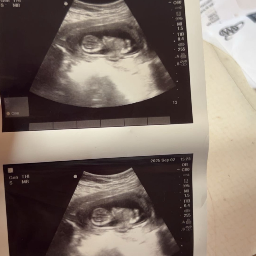 Photo shared by Karin for their Babylist baby registry.