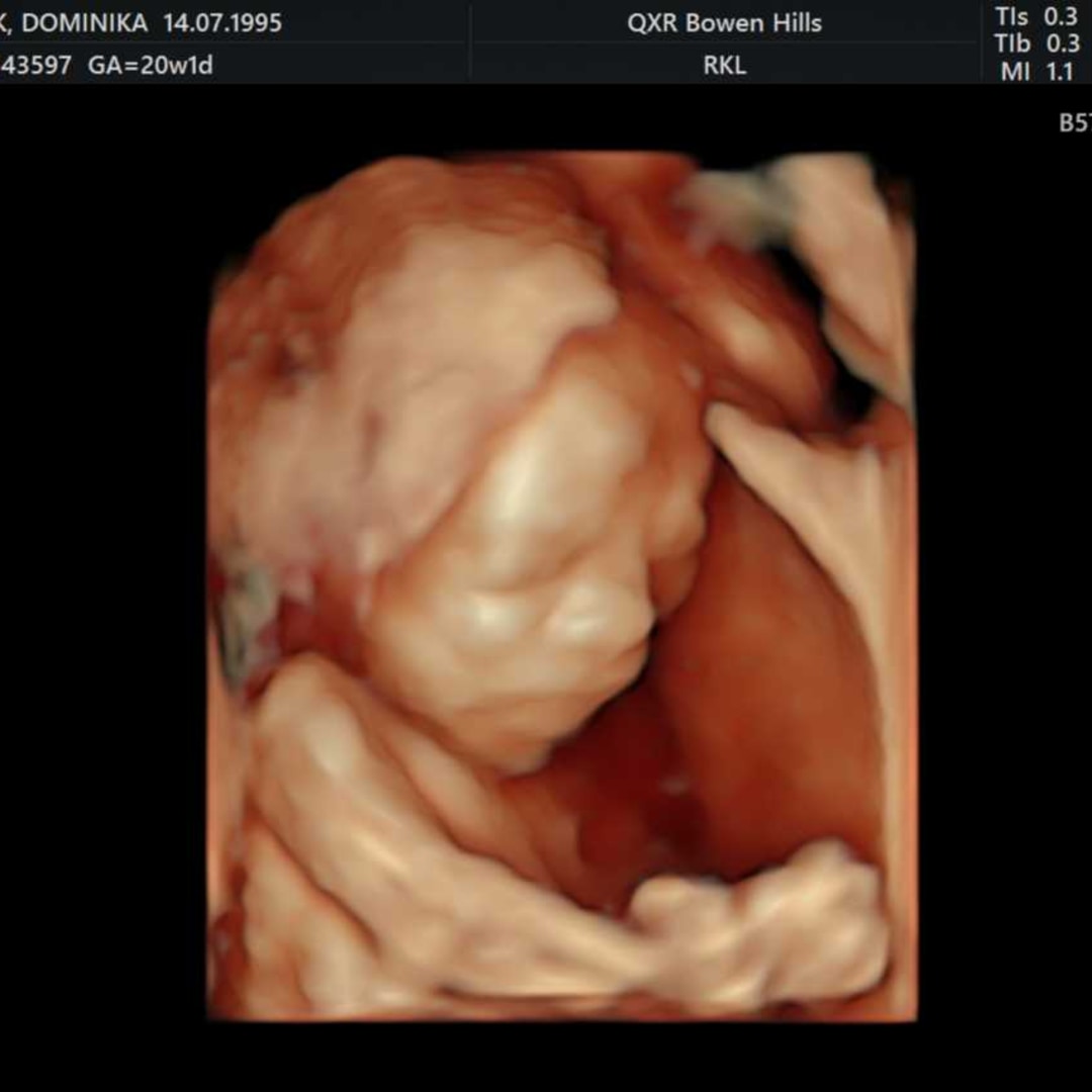 Photo shared by Dominica for their Babylist baby registry.
