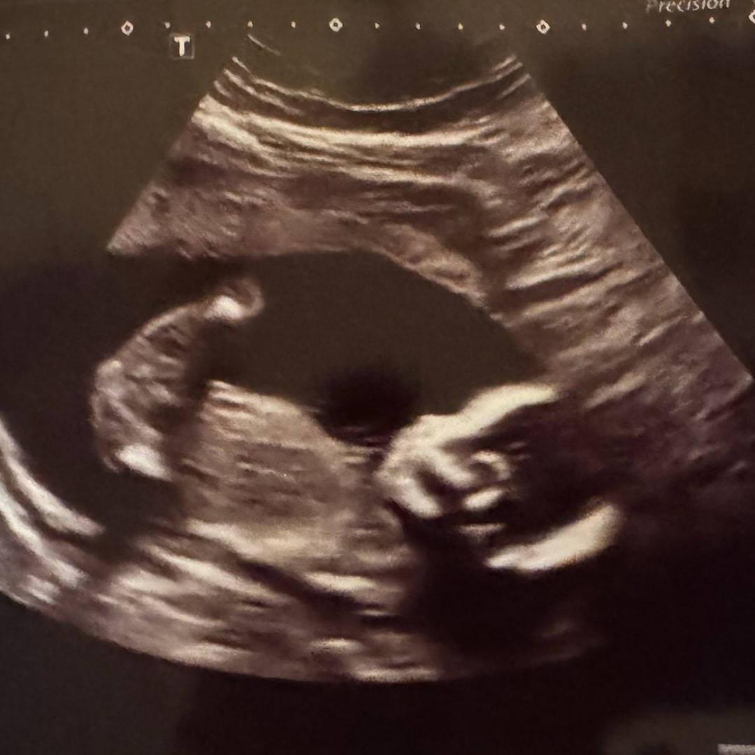 Photo shared by Jocelin for their Babylist baby registry.
