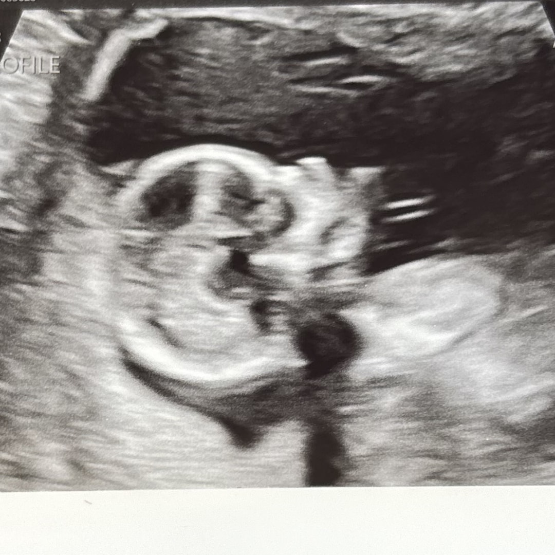 Photo shared by Courtney for their Babylist baby registry.