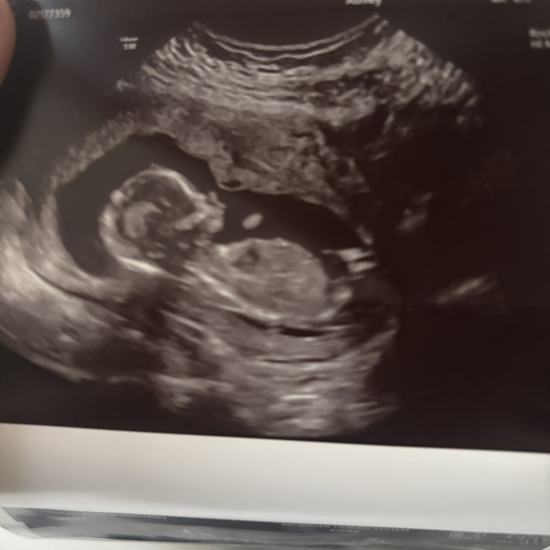 Photo shared by Alden for their Babylist baby registry.