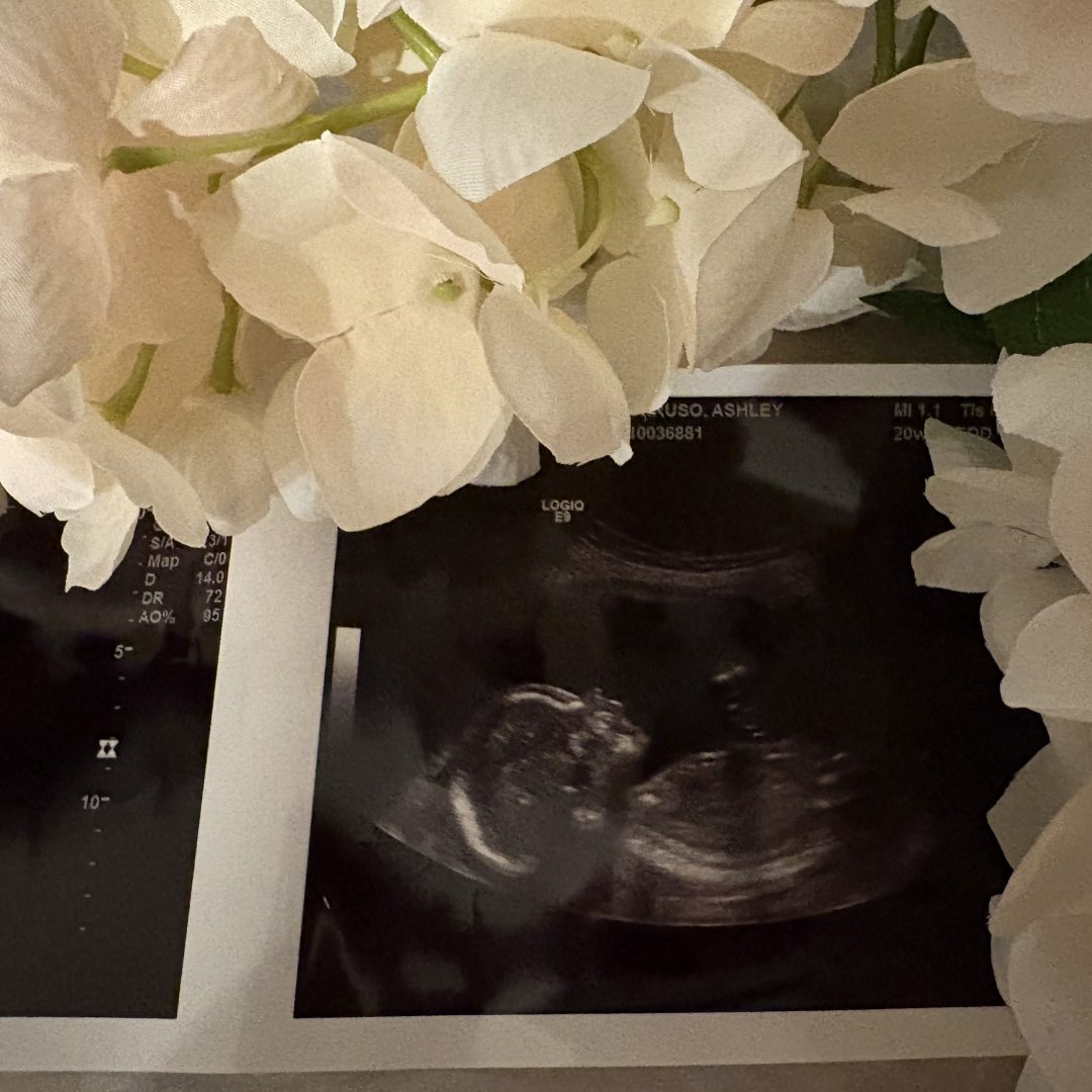 Photo shared by Ashley for their Babylist baby registry.