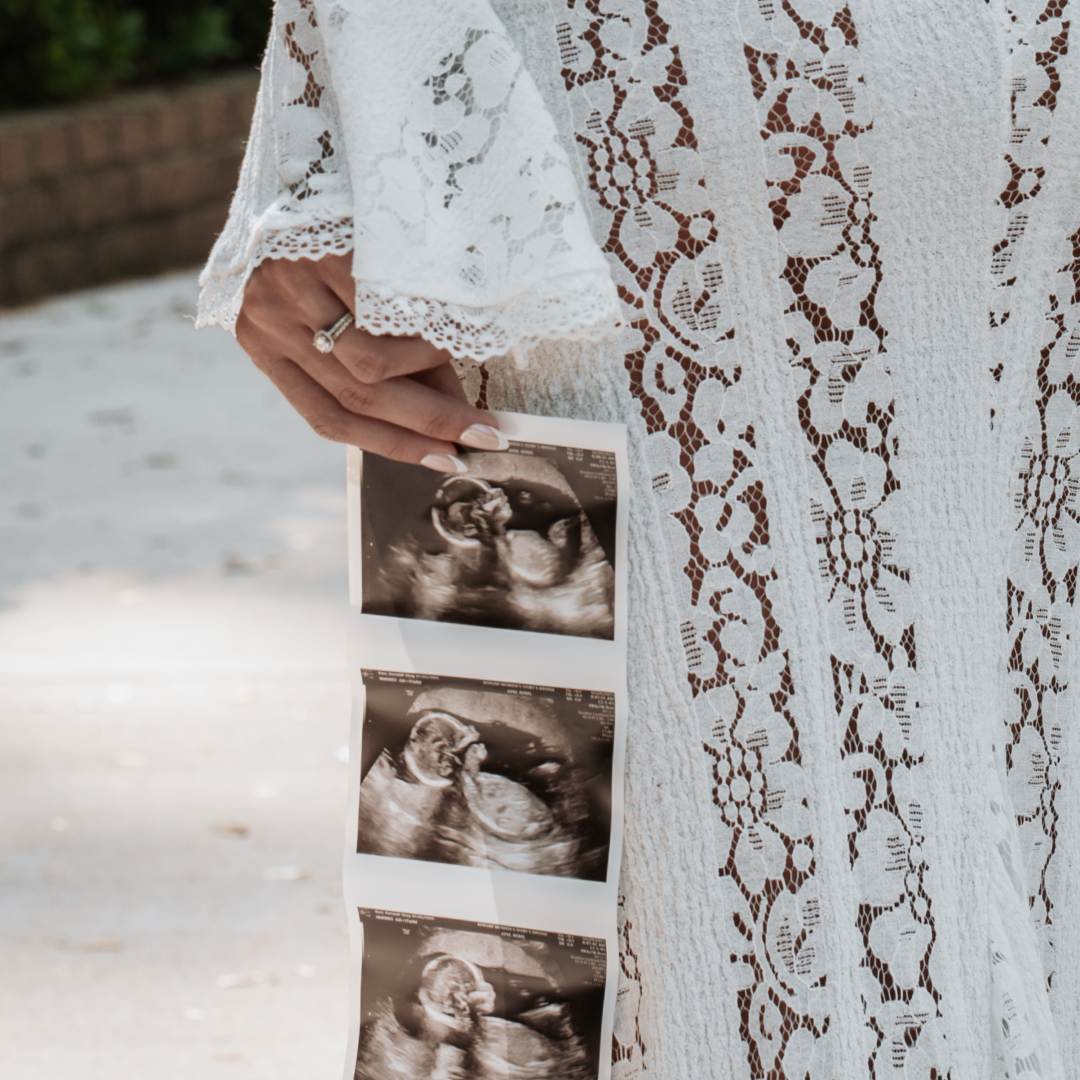 Photo shared by Kendall for their Babylist baby registry.