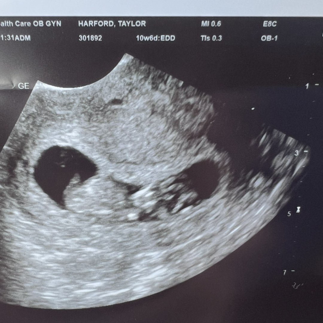 Photo shared by Taylor for their Babylist baby registry.