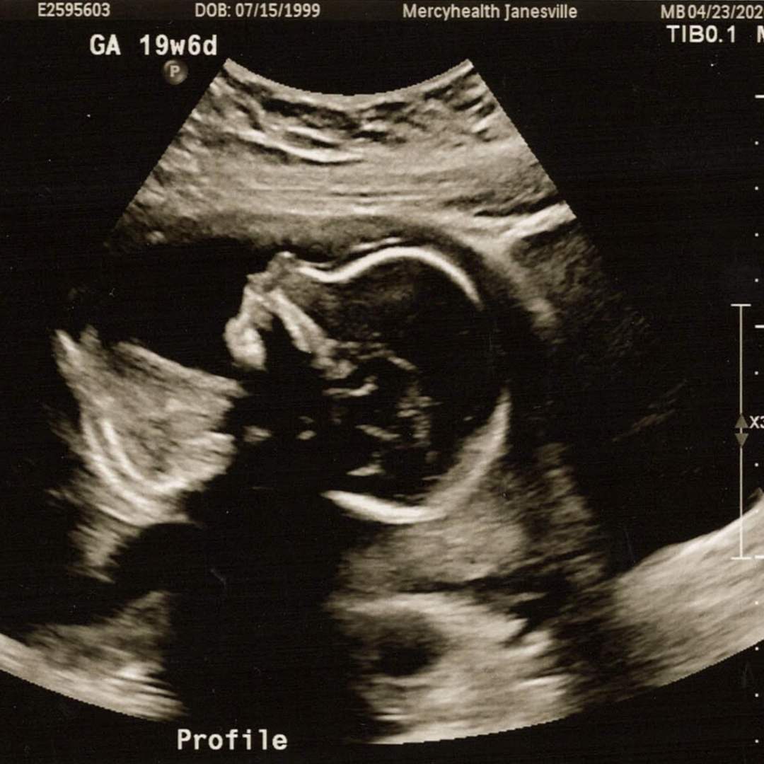 Photo shared by Samantha for their Babylist baby registry.