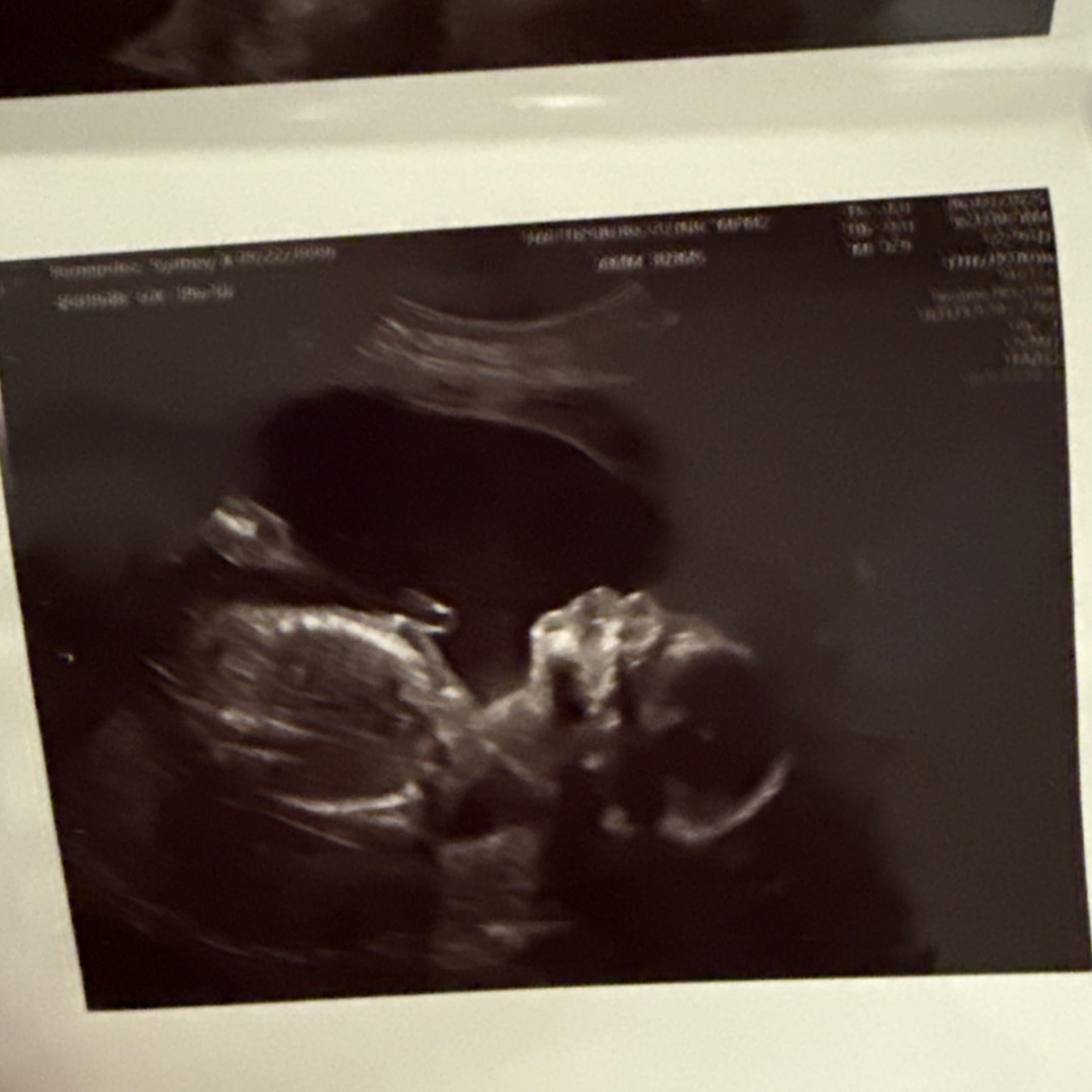 Photo shared by Sydney for their Babylist baby registry.
