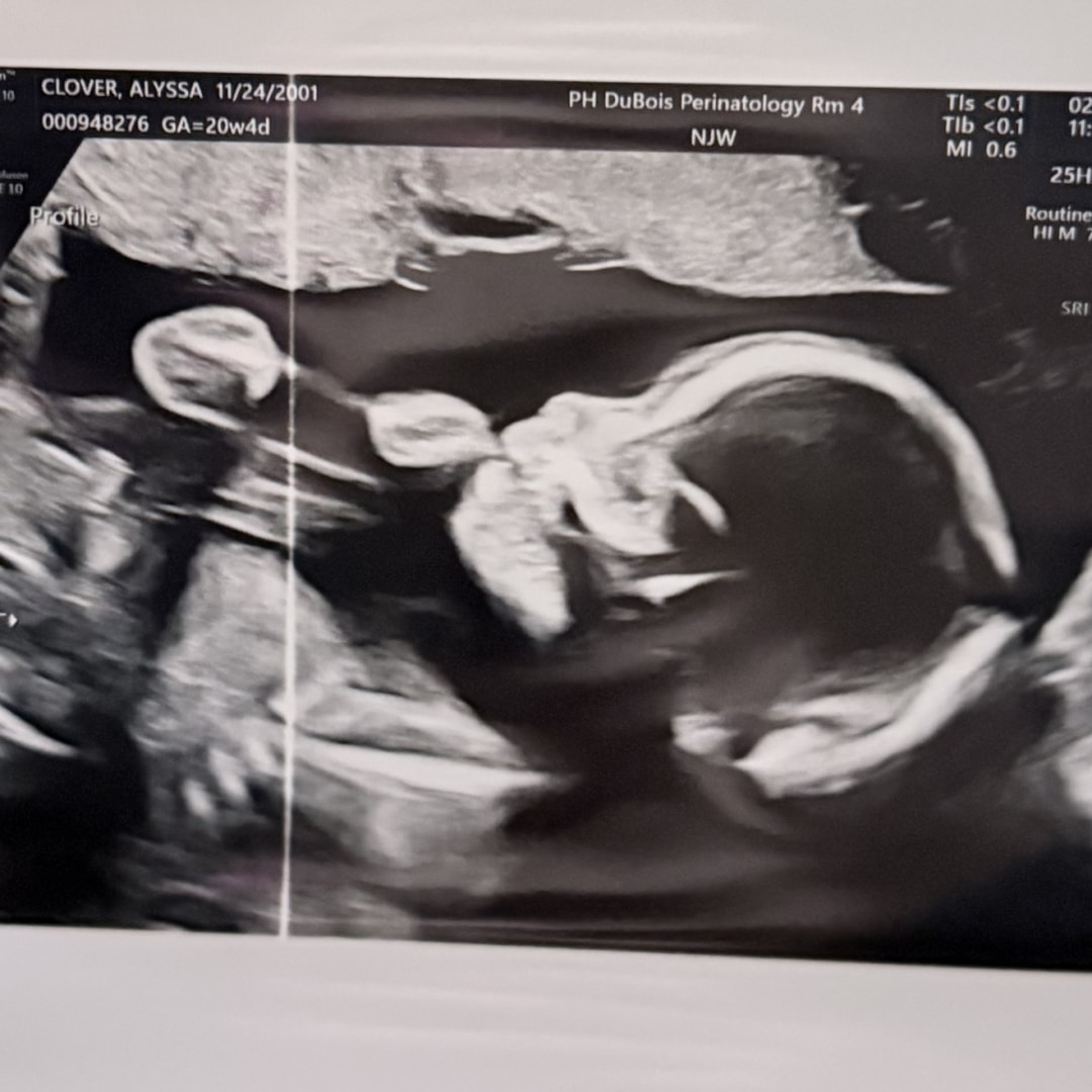 Photo shared by Alyssa for their Babylist baby registry.