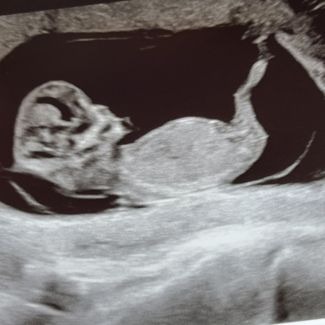 Photo shared by Megan for their Babylist baby registry.