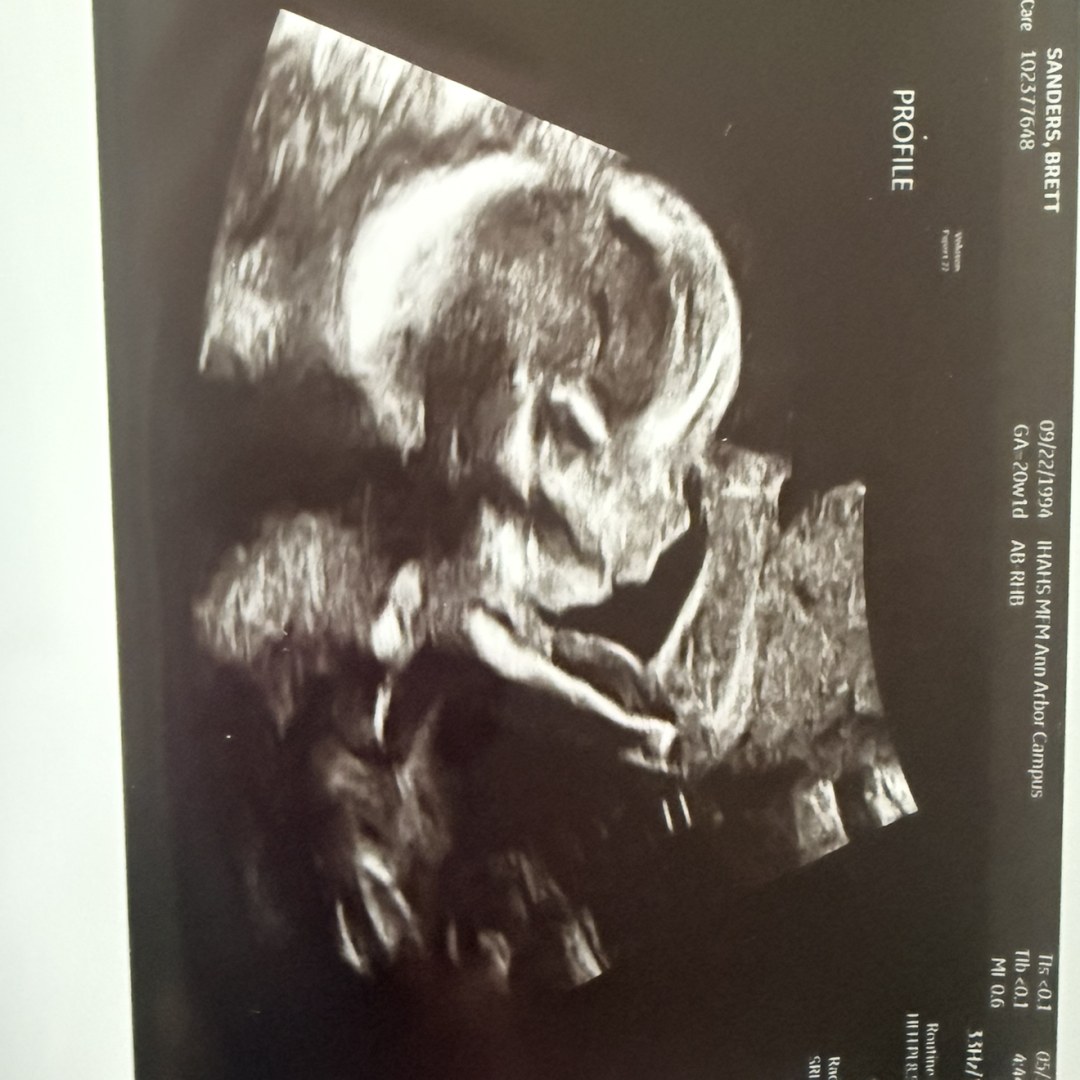 Photo shared by Brett for their Babylist baby registry.