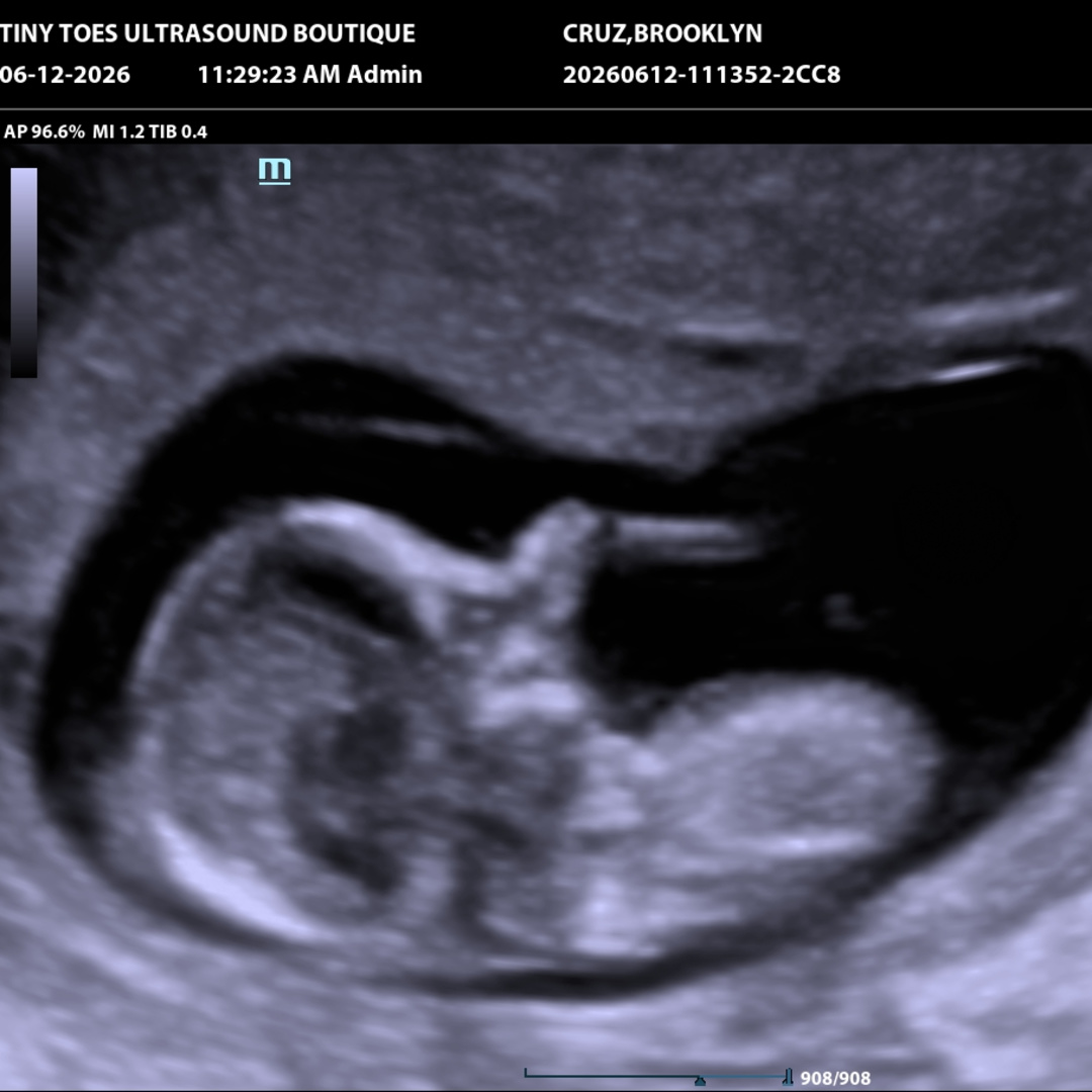 Photo shared by Brooklyn for their Babylist baby registry.