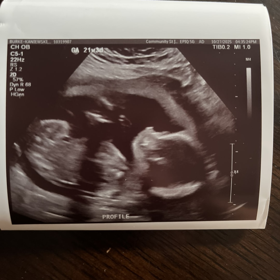 Photo shared by Emily for their Babylist baby registry.