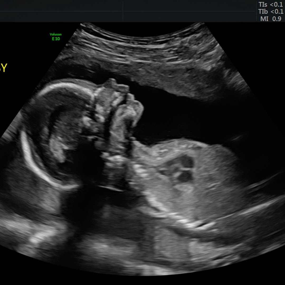 Photo shared by Lauren for their Babylist baby registry.