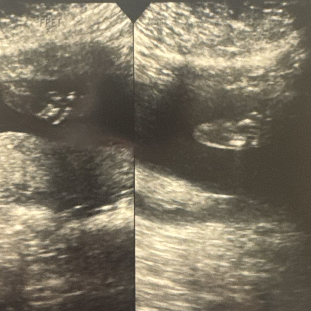 Photo shared by Madison for their Babylist baby registry.