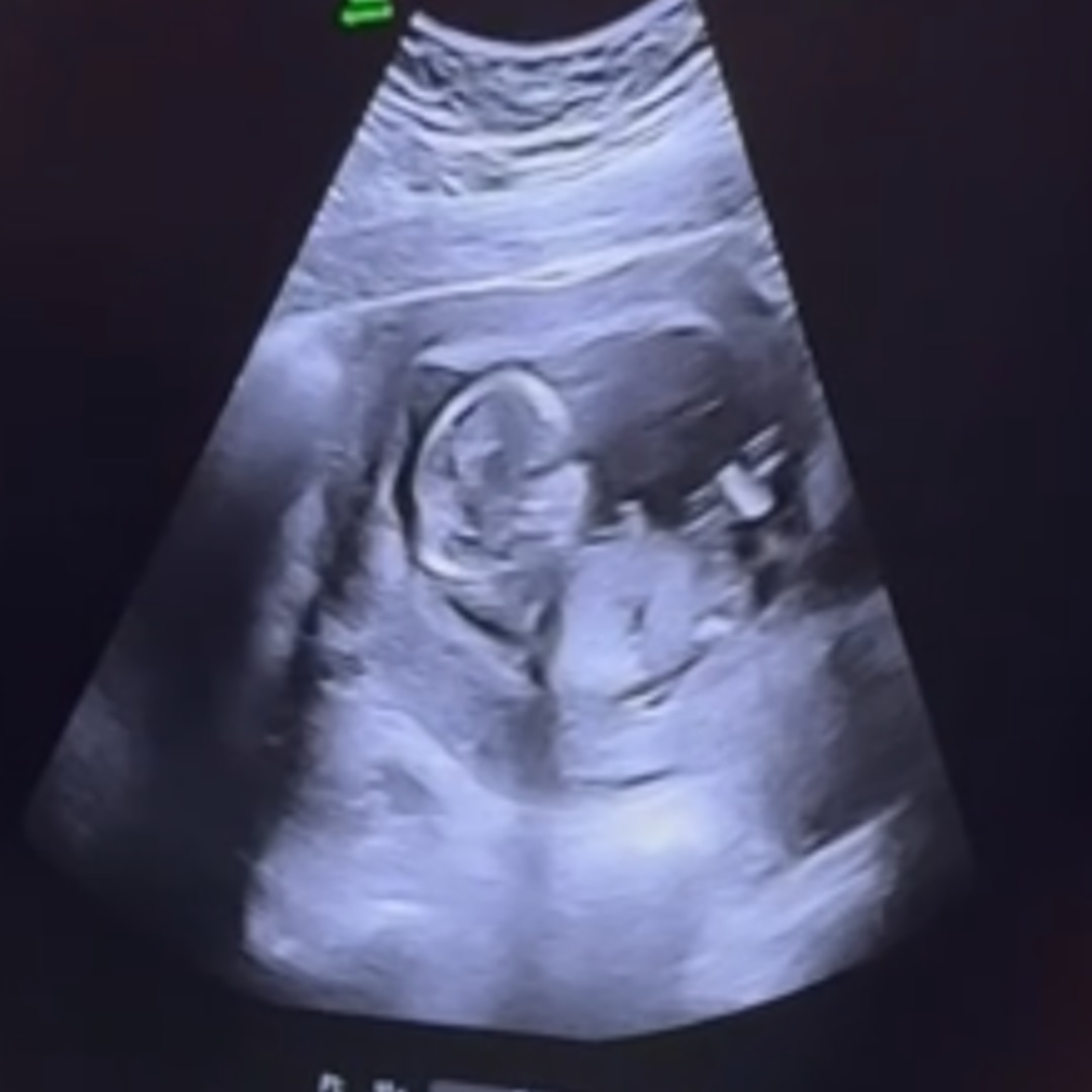 Photo shared by Bobbilee for their Babylist baby registry.