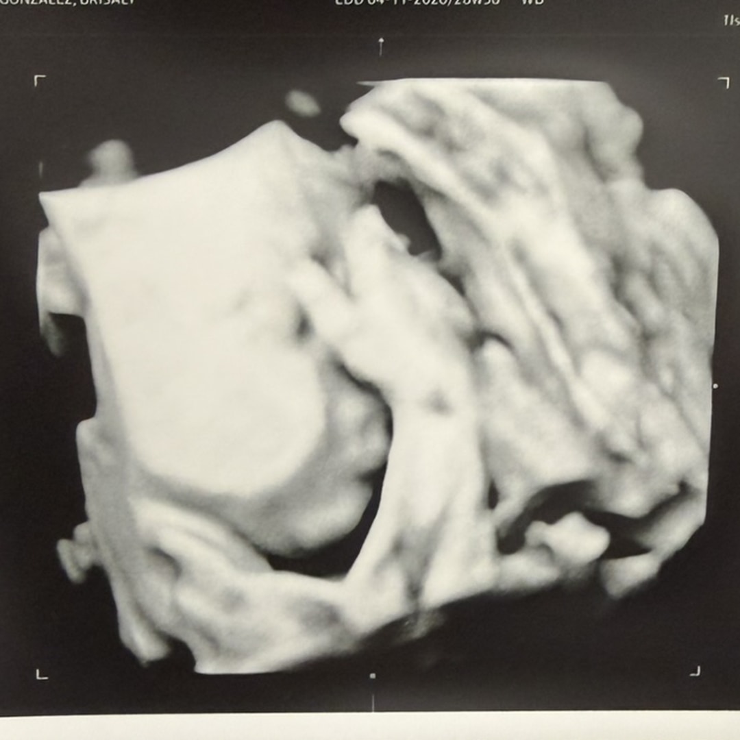 Photo shared by Brisaly for their Babylist baby registry.