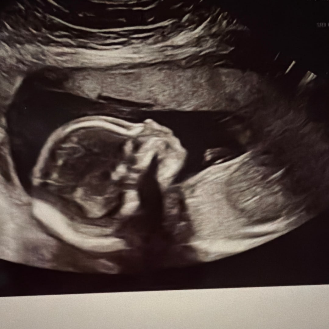 Photo shared by Melanie for their Babylist baby registry.
