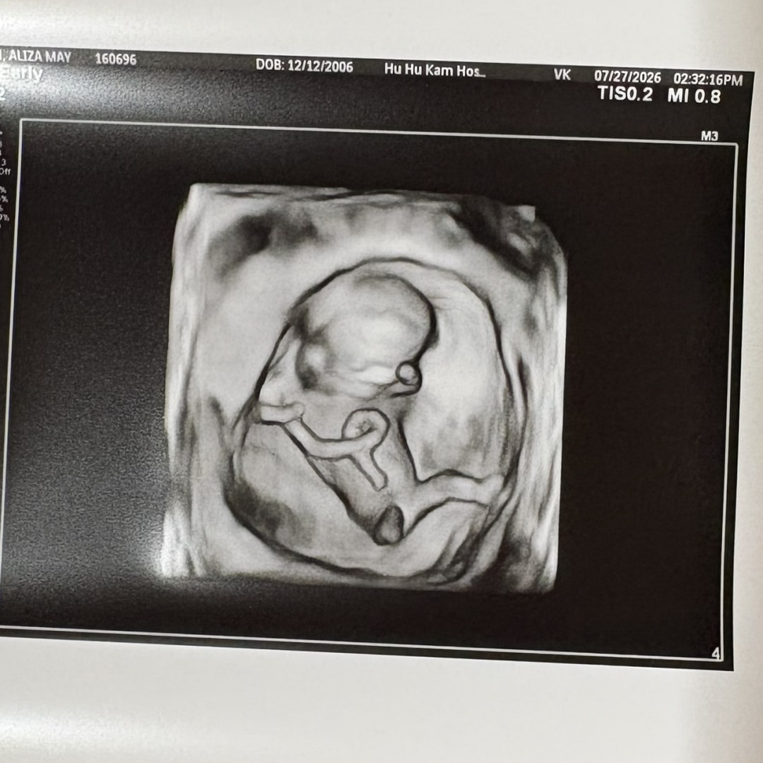 Photo shared by Aliza for their Babylist baby registry.
