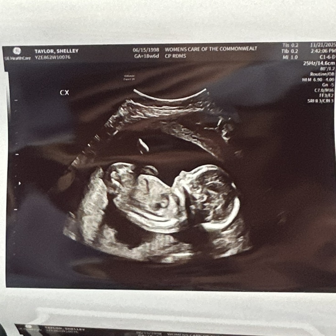 Photo shared by Taylor for their Babylist baby registry.