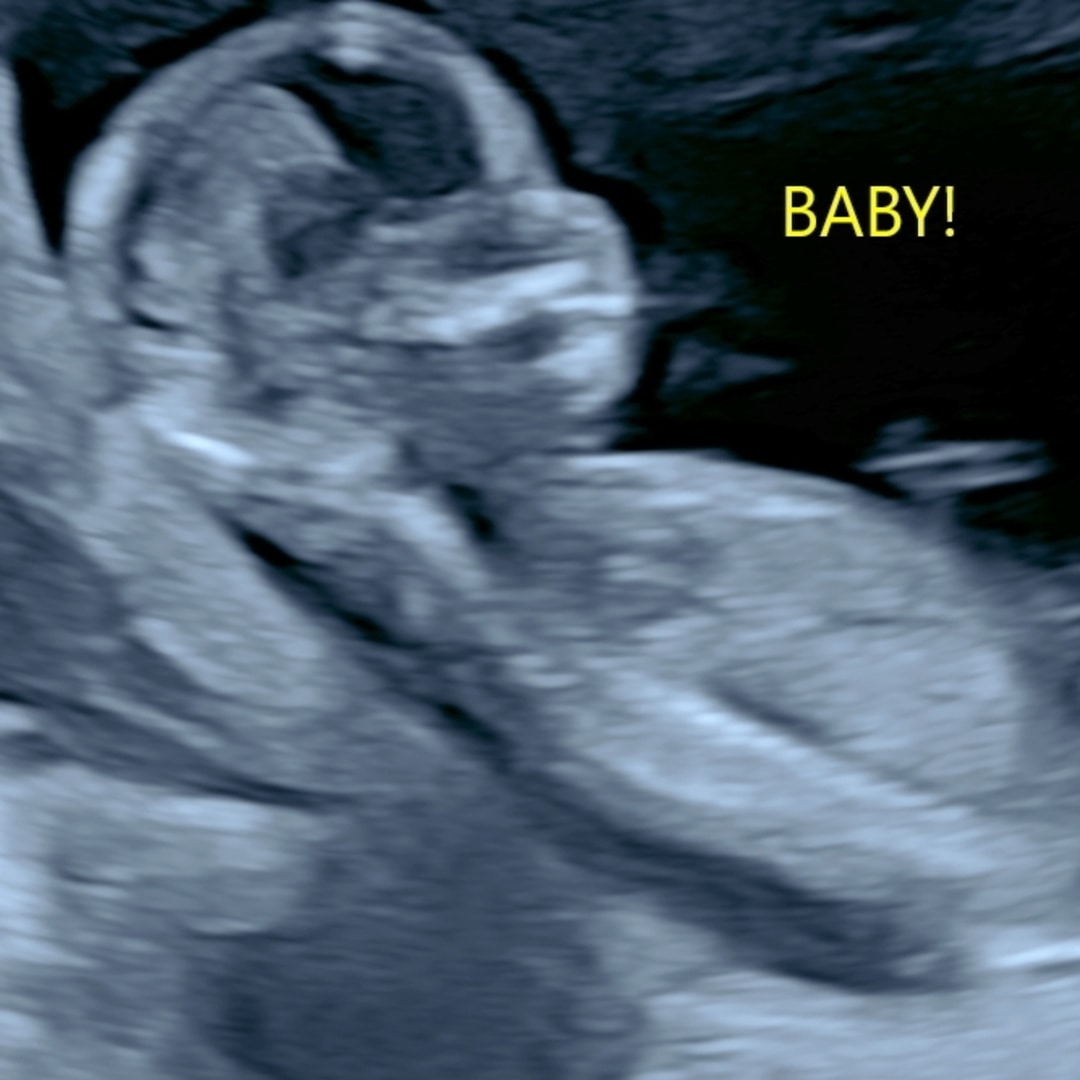 Photo shared by Blayne for their Babylist baby registry.