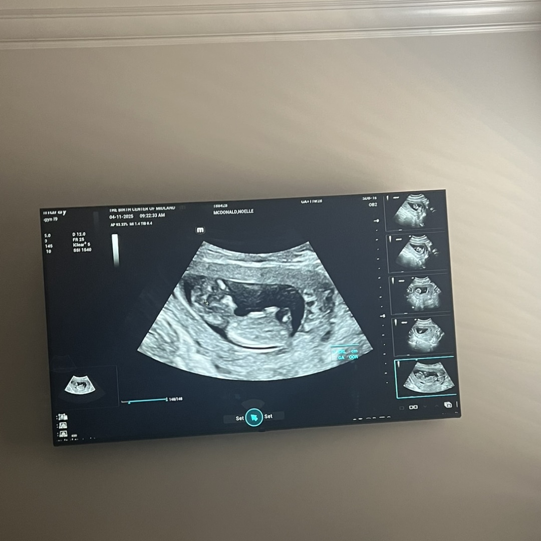 Photo shared by Noelle for their Babylist baby registry.