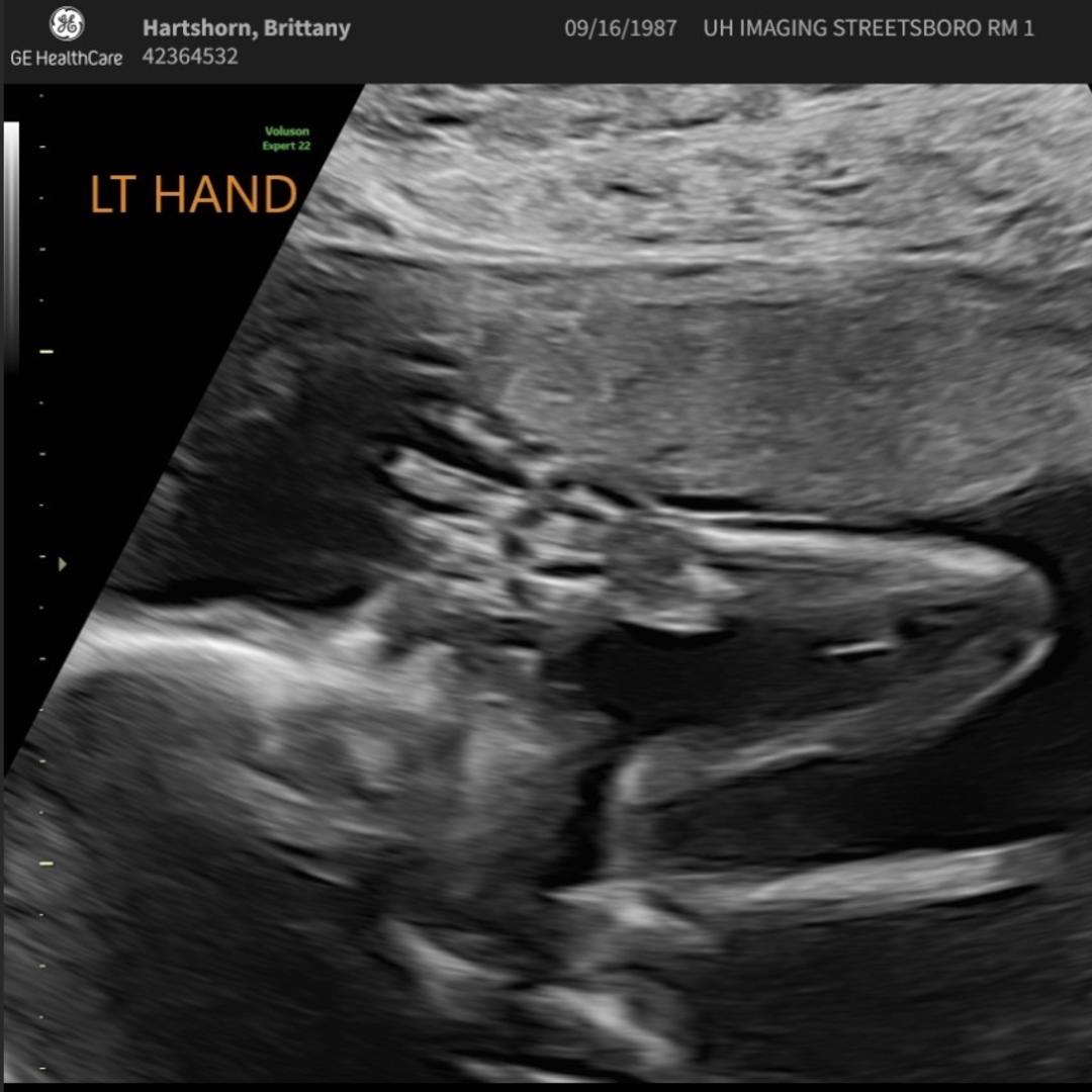 Photo shared by Brittany for their Babylist baby registry.