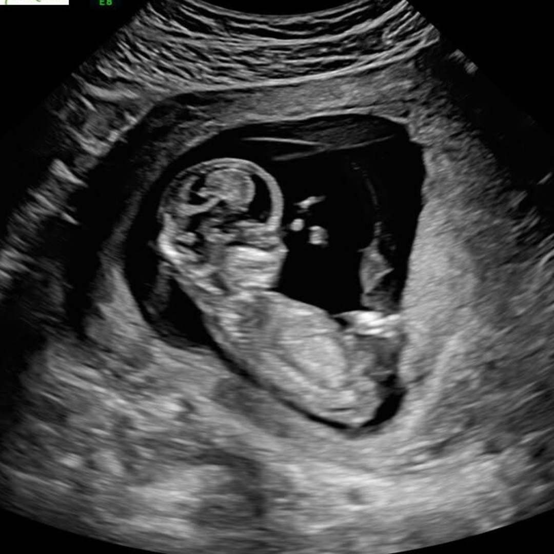 Photo shared by Natasha for their Babylist baby registry.