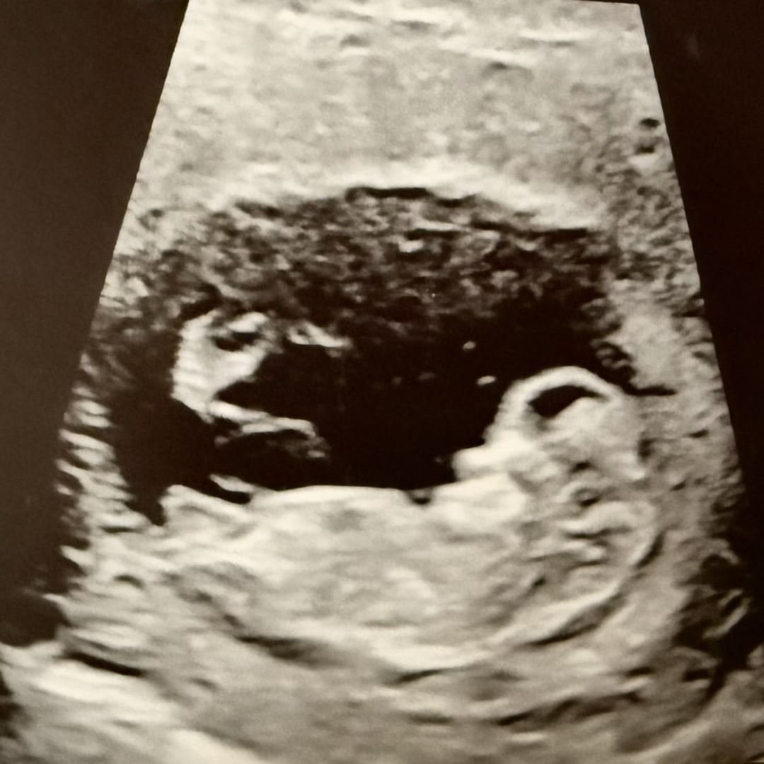 Photo shared by Ashley for their Babylist baby registry.