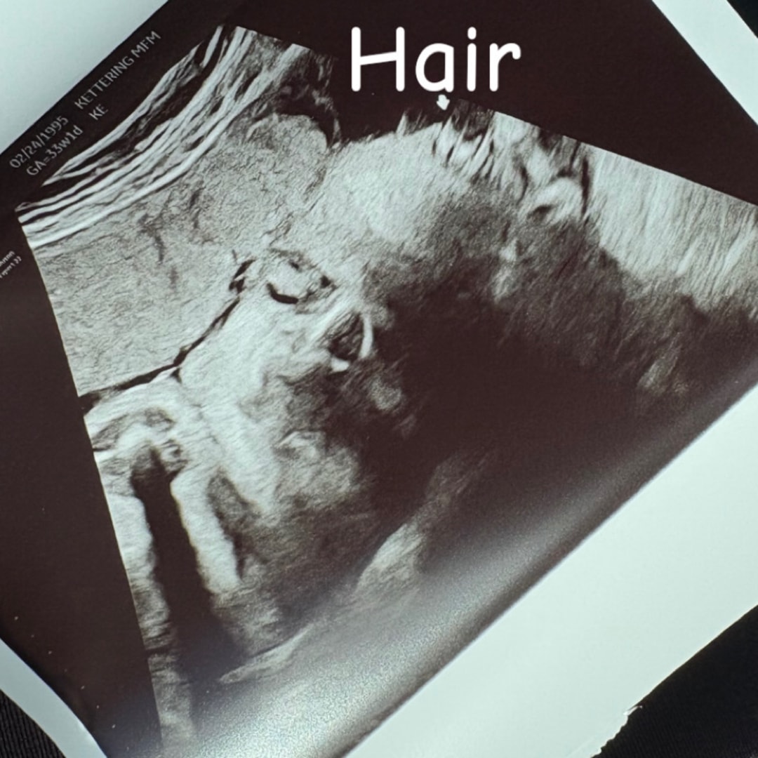 Photo shared by Madyson for their Babylist baby registry.
