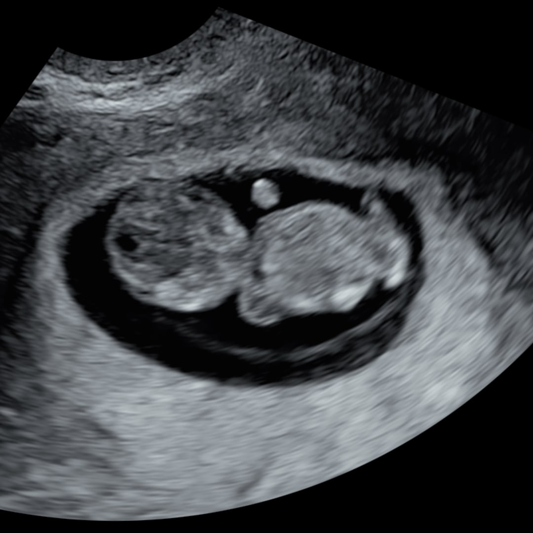 Photo shared by Marja for their Babylist baby registry.