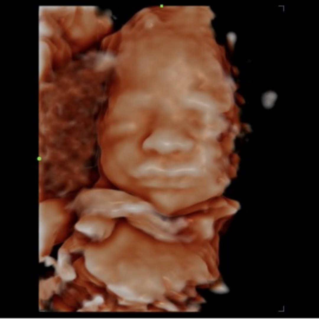 Photo shared by Lydia for their Babylist baby registry.
