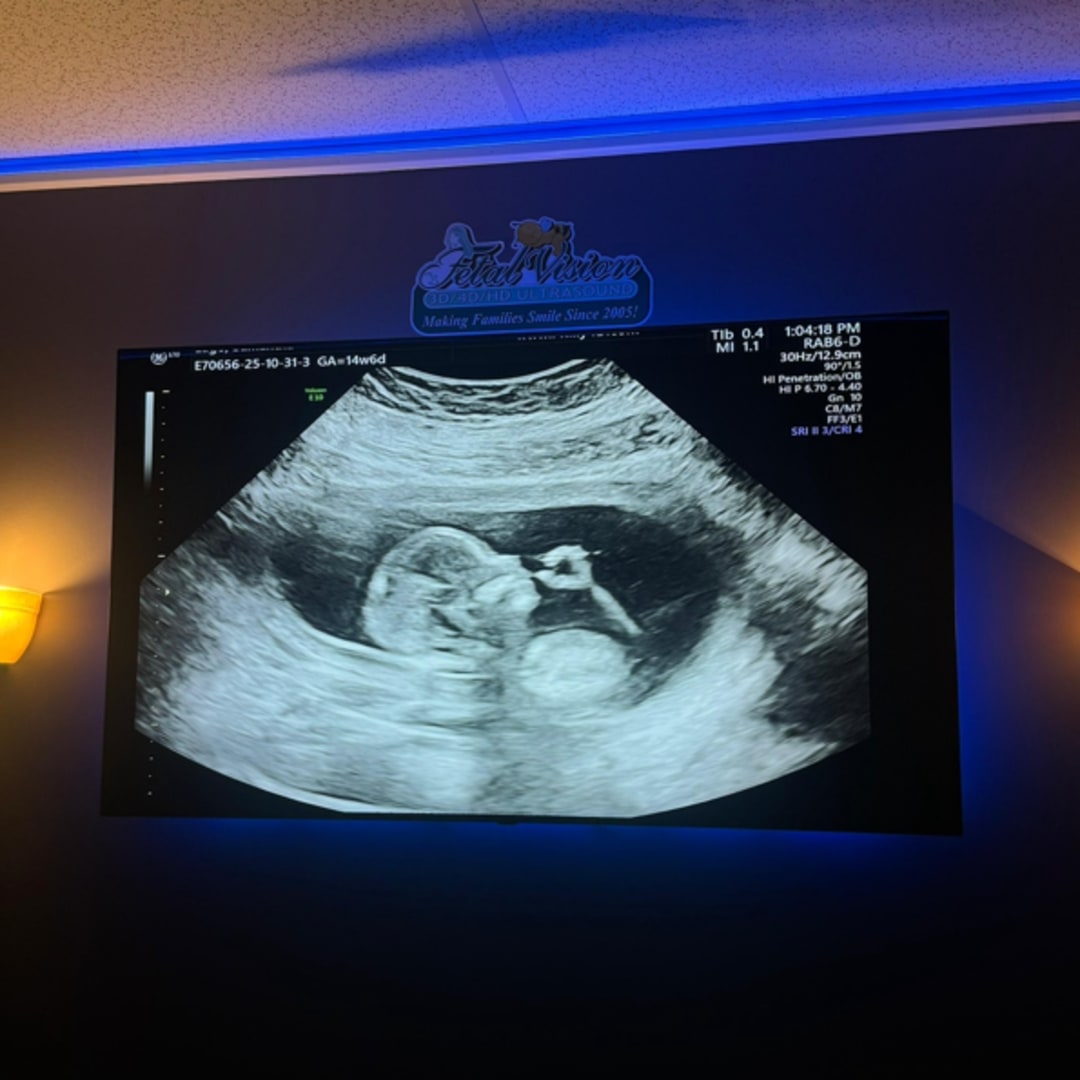 Photo shared by Samantha for their Babylist baby registry.