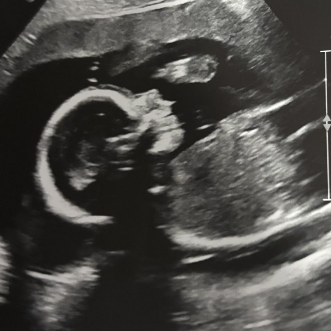 Photo shared by Brittany for their Babylist baby registry.